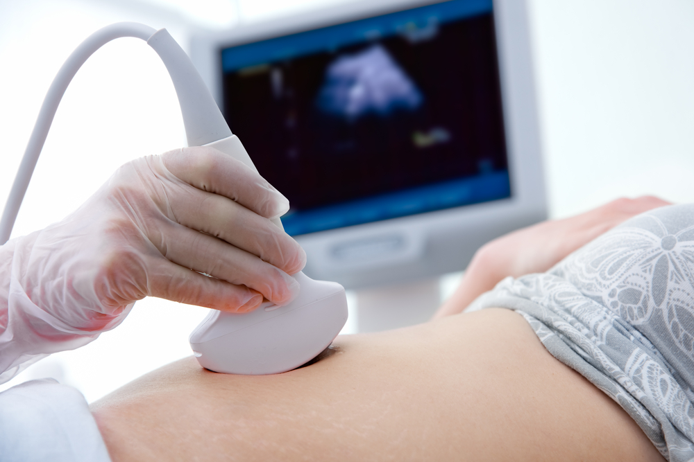 Pregnancy Ultrasound